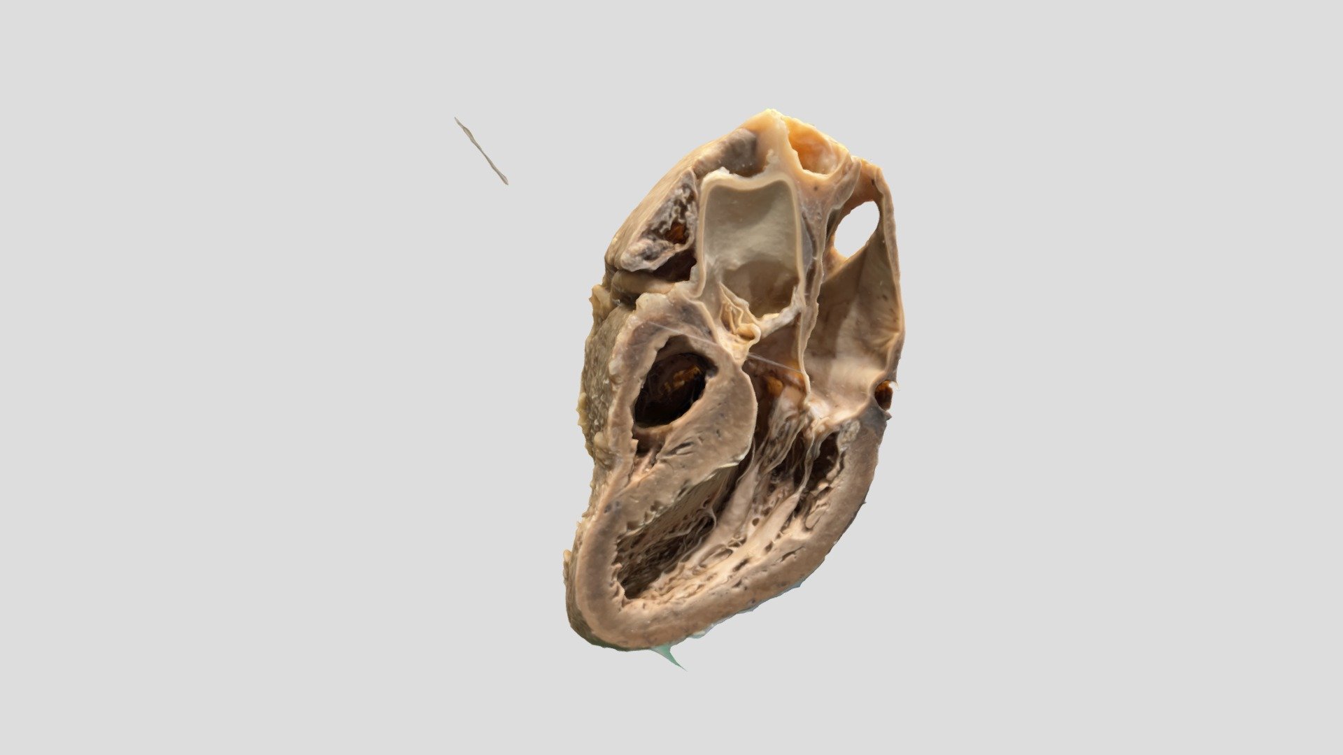 Parasternal Long Axis of the Heart 3, Right_RS - 3D model by shearjak ...