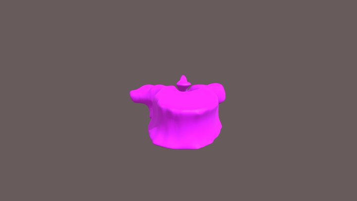 Segmentation Vertebrae 3D Model