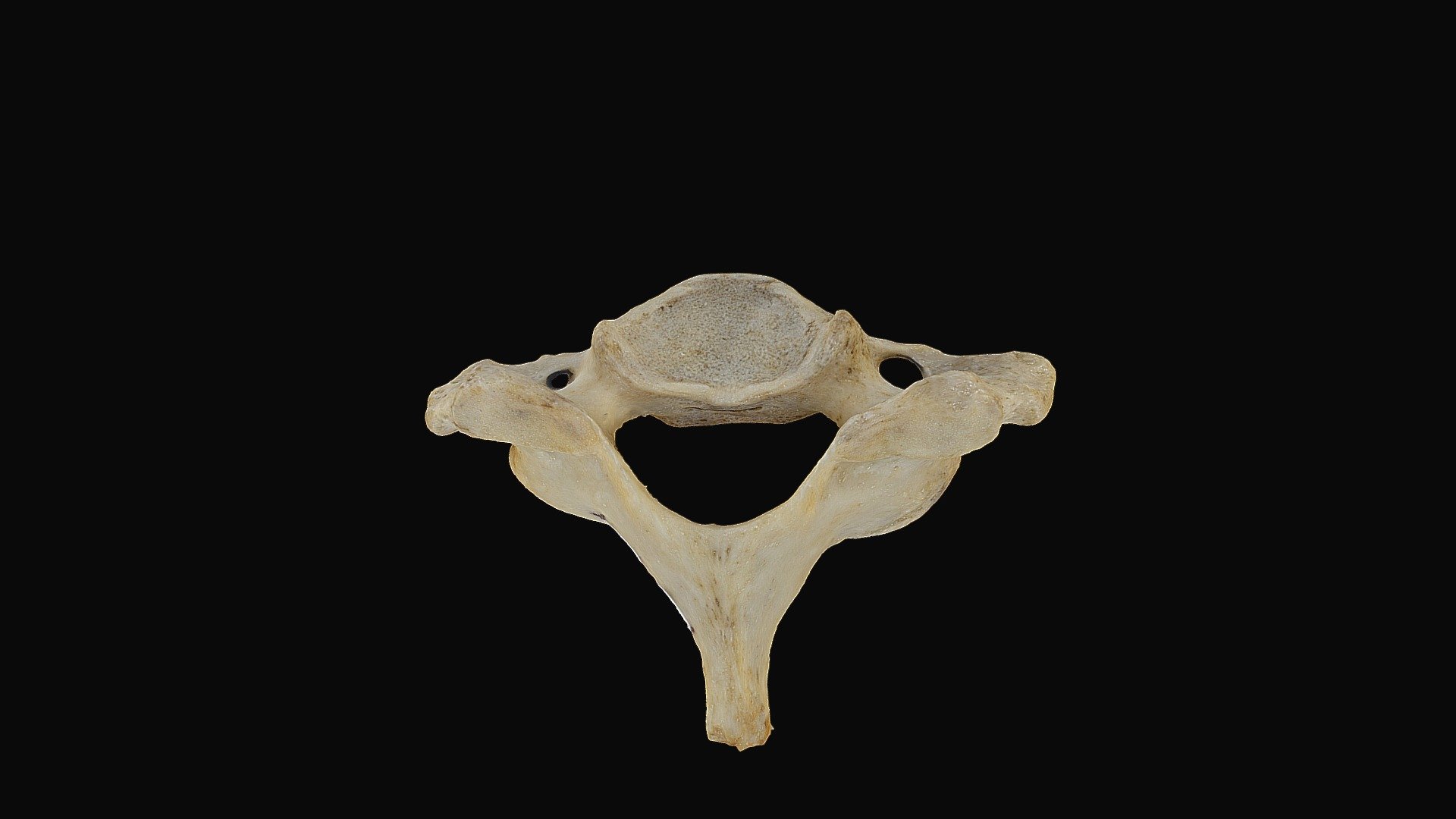 Cervical Vertebra with cut mark