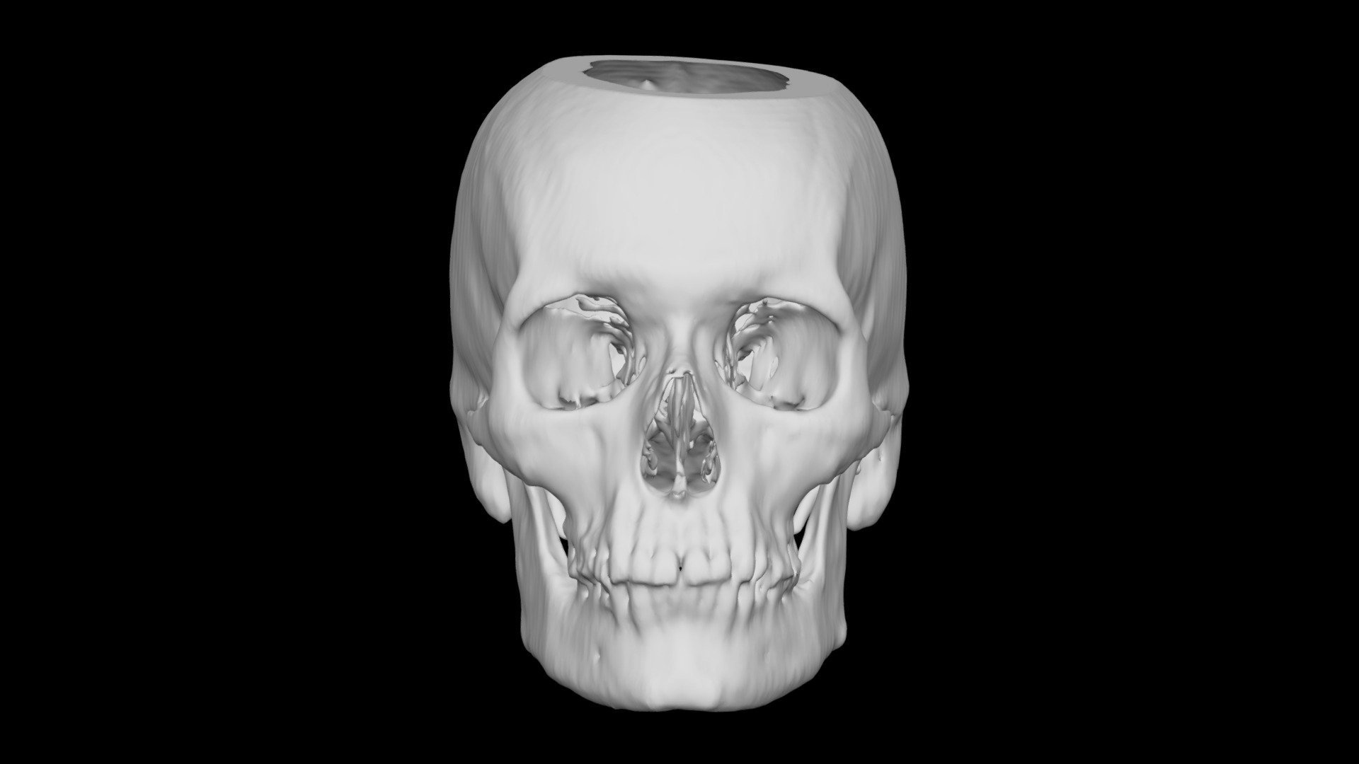 Skull Male 72yo