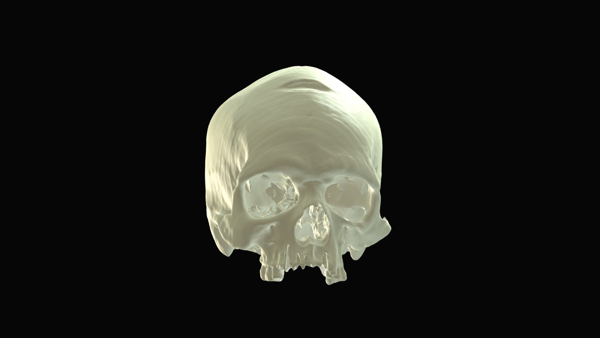 Sharp force trauma to a human skull