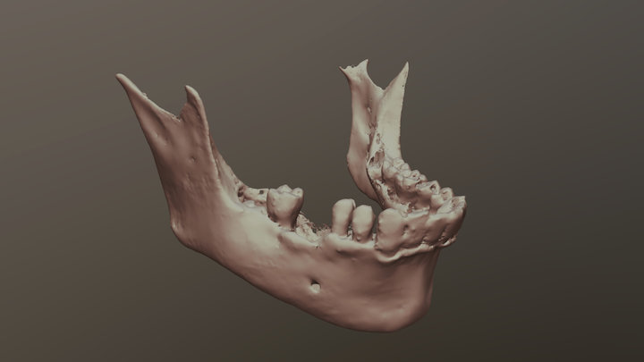CBCT_Mandible 3D Model