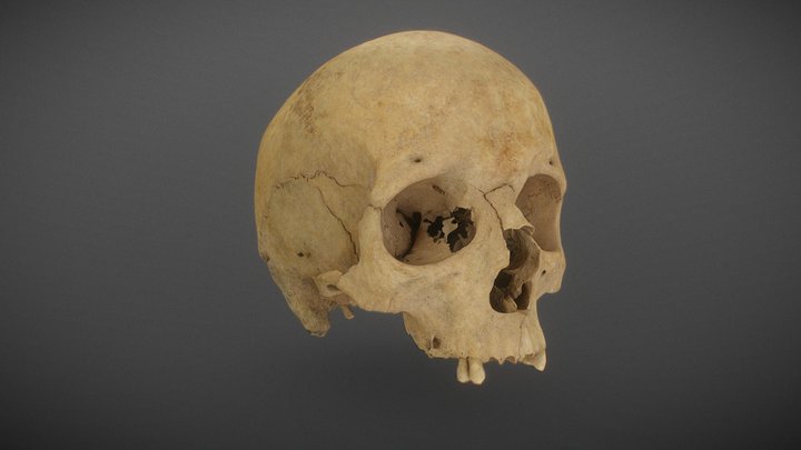 Human cranium 3D Model