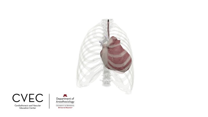 Transesophageal Echocardiography Probe 3D Model