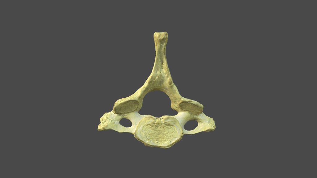 Cervical Vertebra 4 with Texture