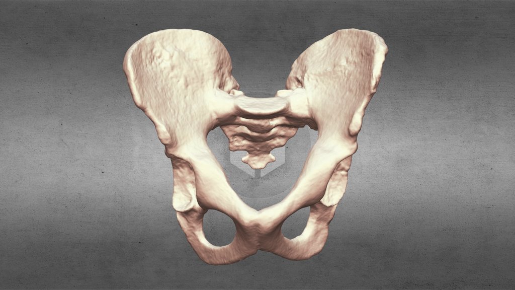 Homo Ergaster Pelvis KNM-WT 15000