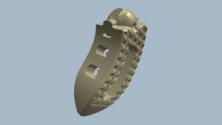 Stearable Implant 3D Model