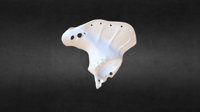Medical Implant 3D Model