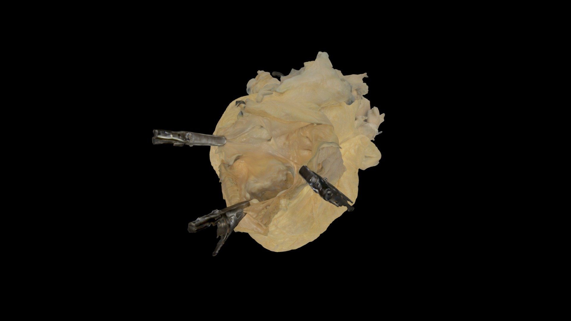 Perfusion Fixed Human Heart #268