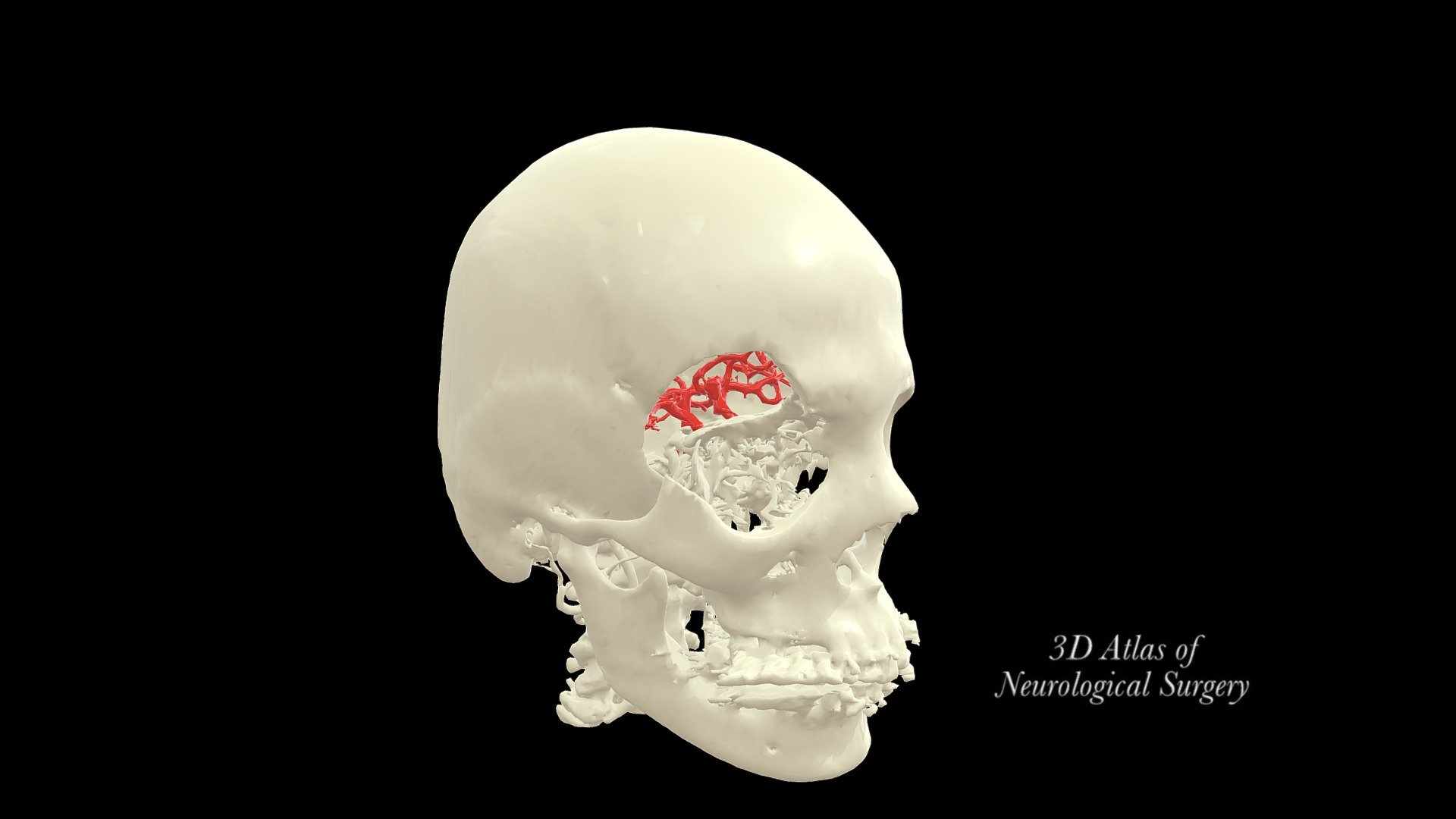 Lateral Orbital 3d Model By 3d Atlas Of Neurological Surgery Tspiriev 61ce5c8 Sketchfab 3949
