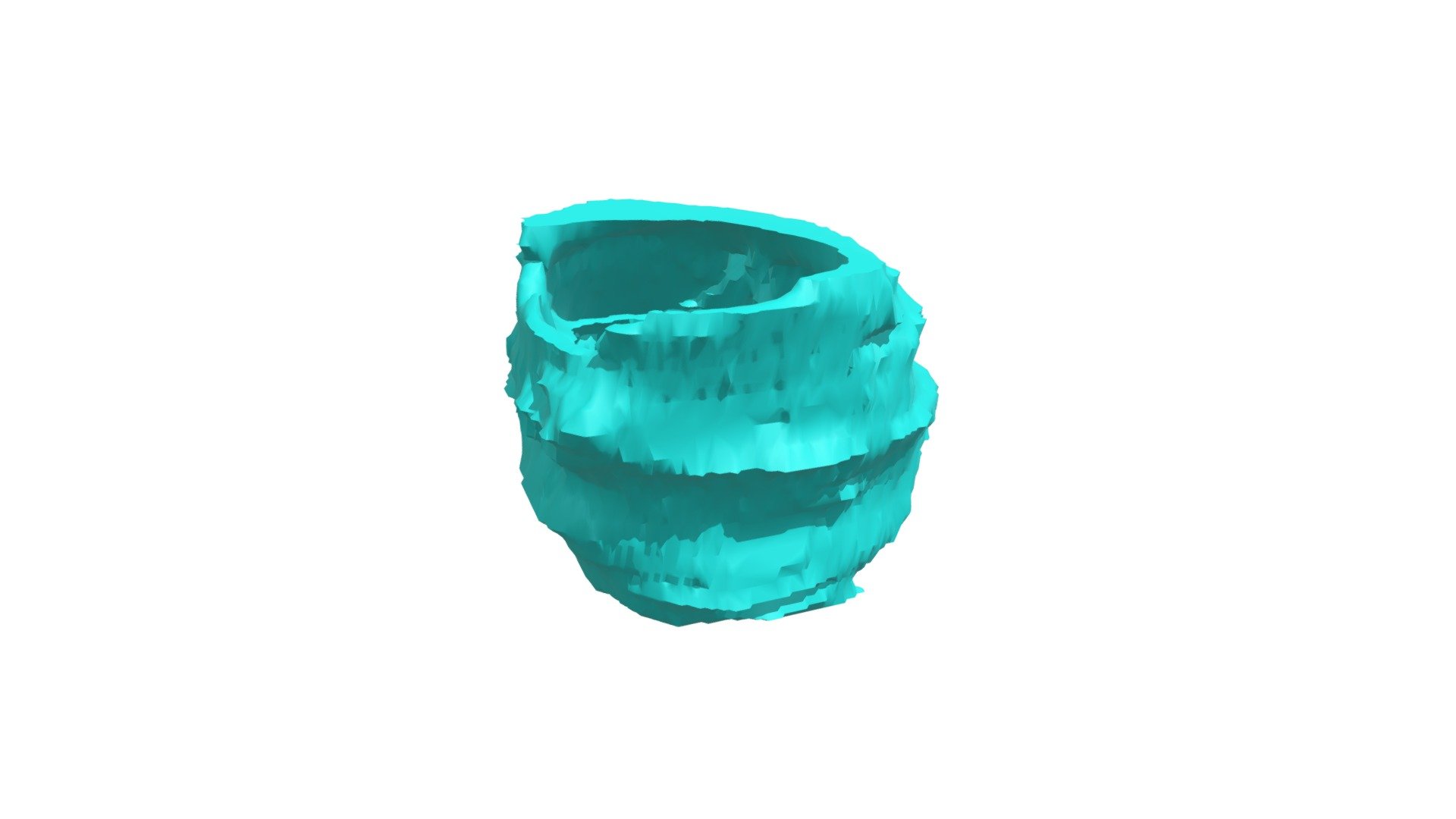 HH141_Aortic Valve 21_001