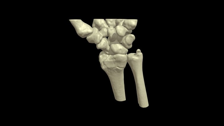 Human wrist segmented from CT 3D Model