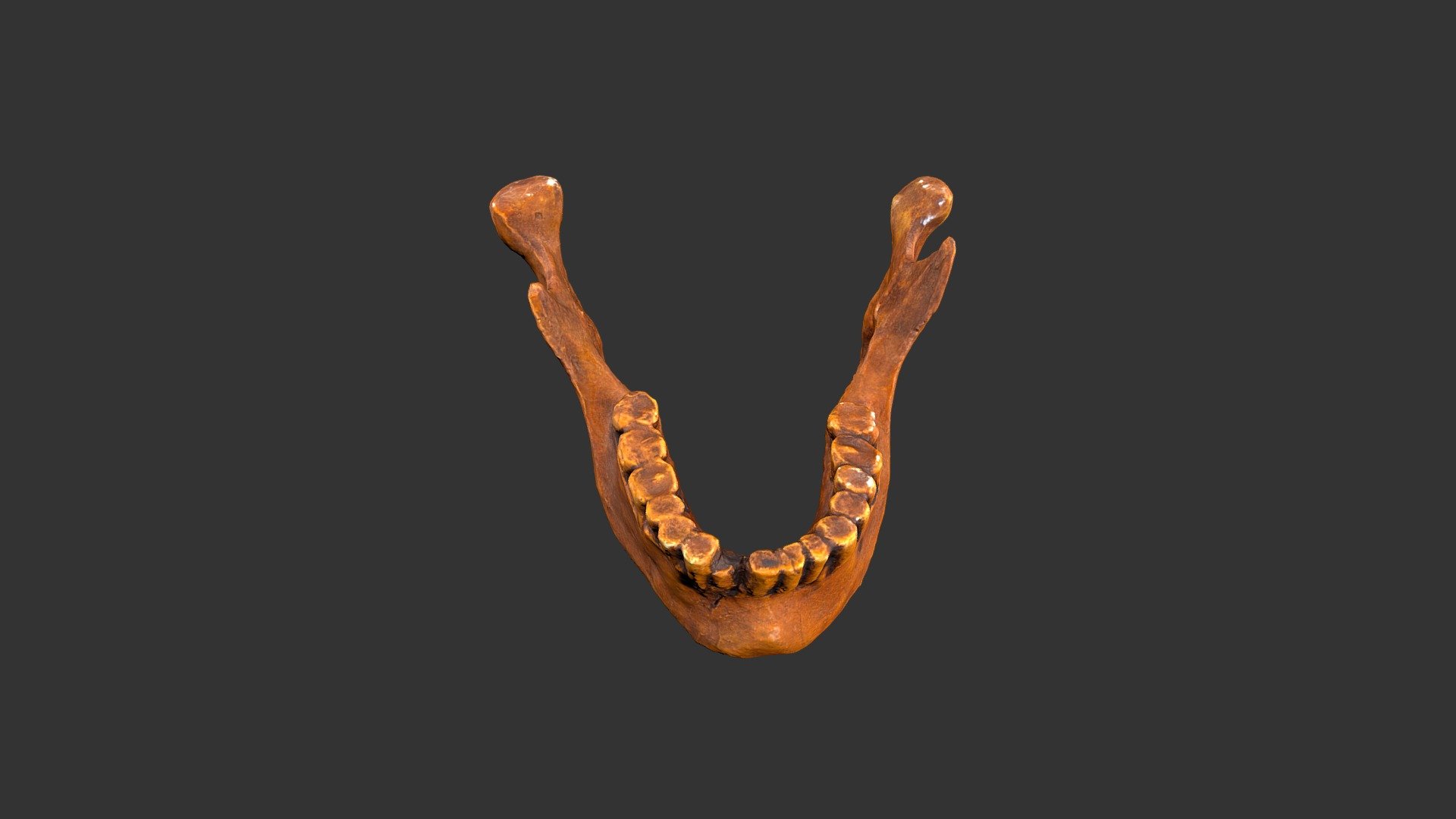 Homo sapiens (Predmost 3) (1979rp47-1)- mandible