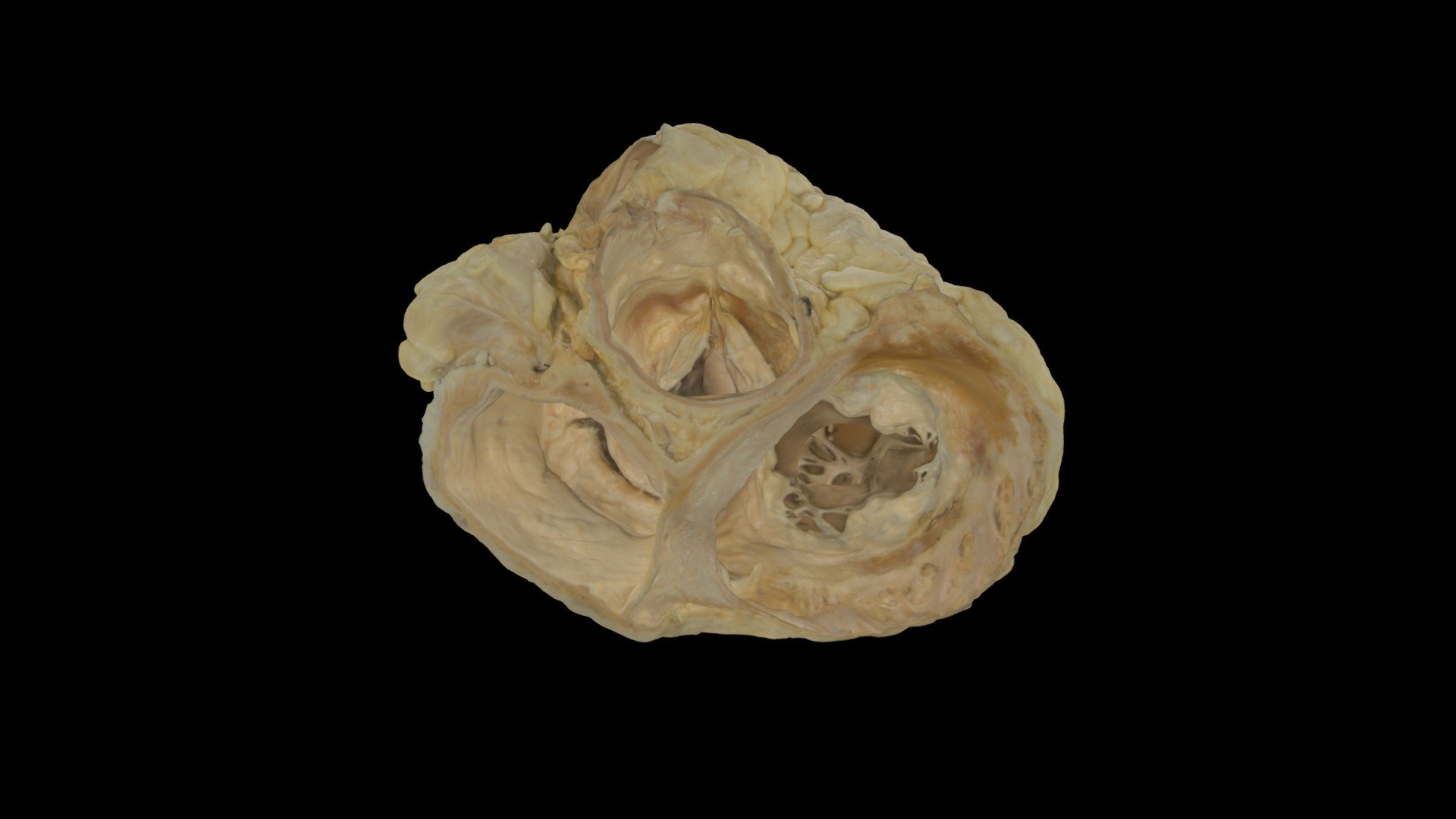 Plastinated Human Hear Valve View Heart0064