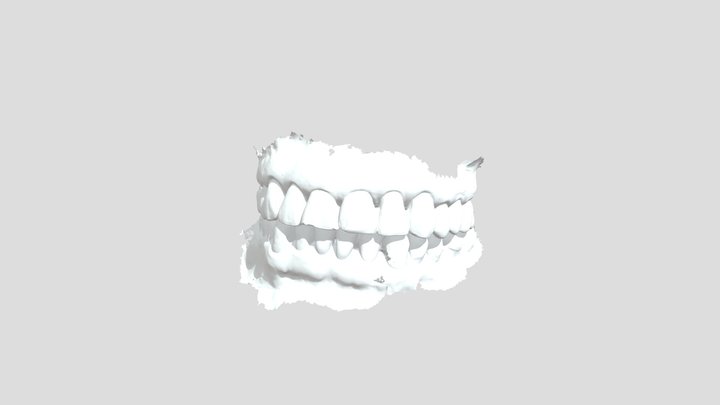 Wax Up 1 3D Model