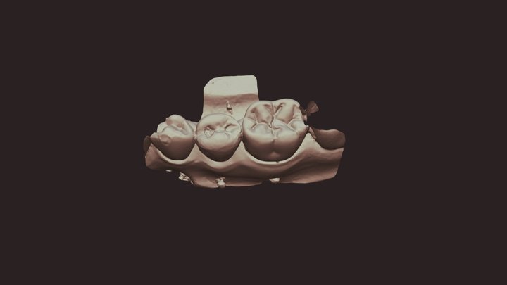 Group 6 Wax 20 A Lower Jaw 3D Model