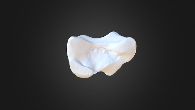 1310002 Intermediate Carpal Right 3D Model