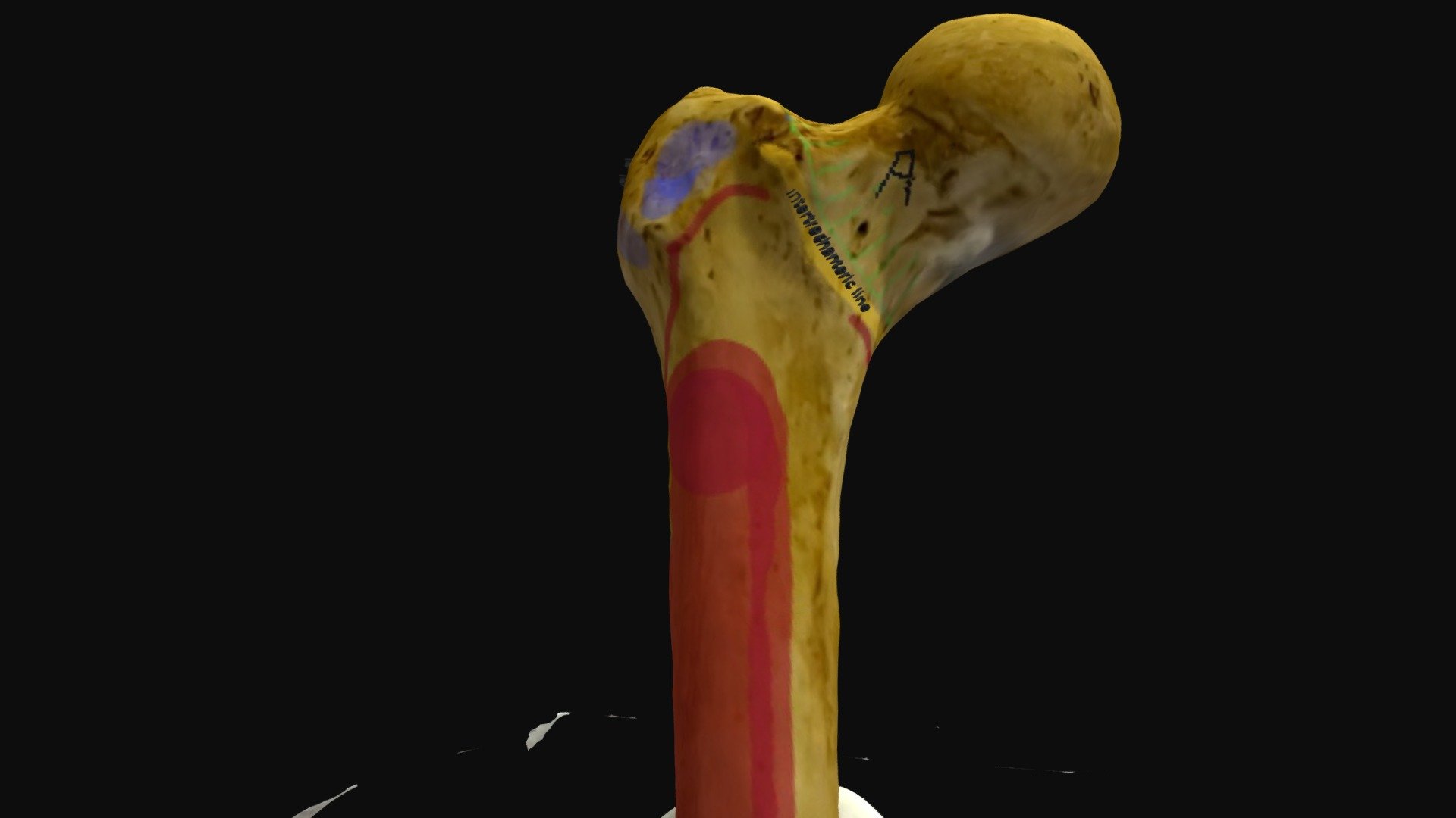 Femur Upper End