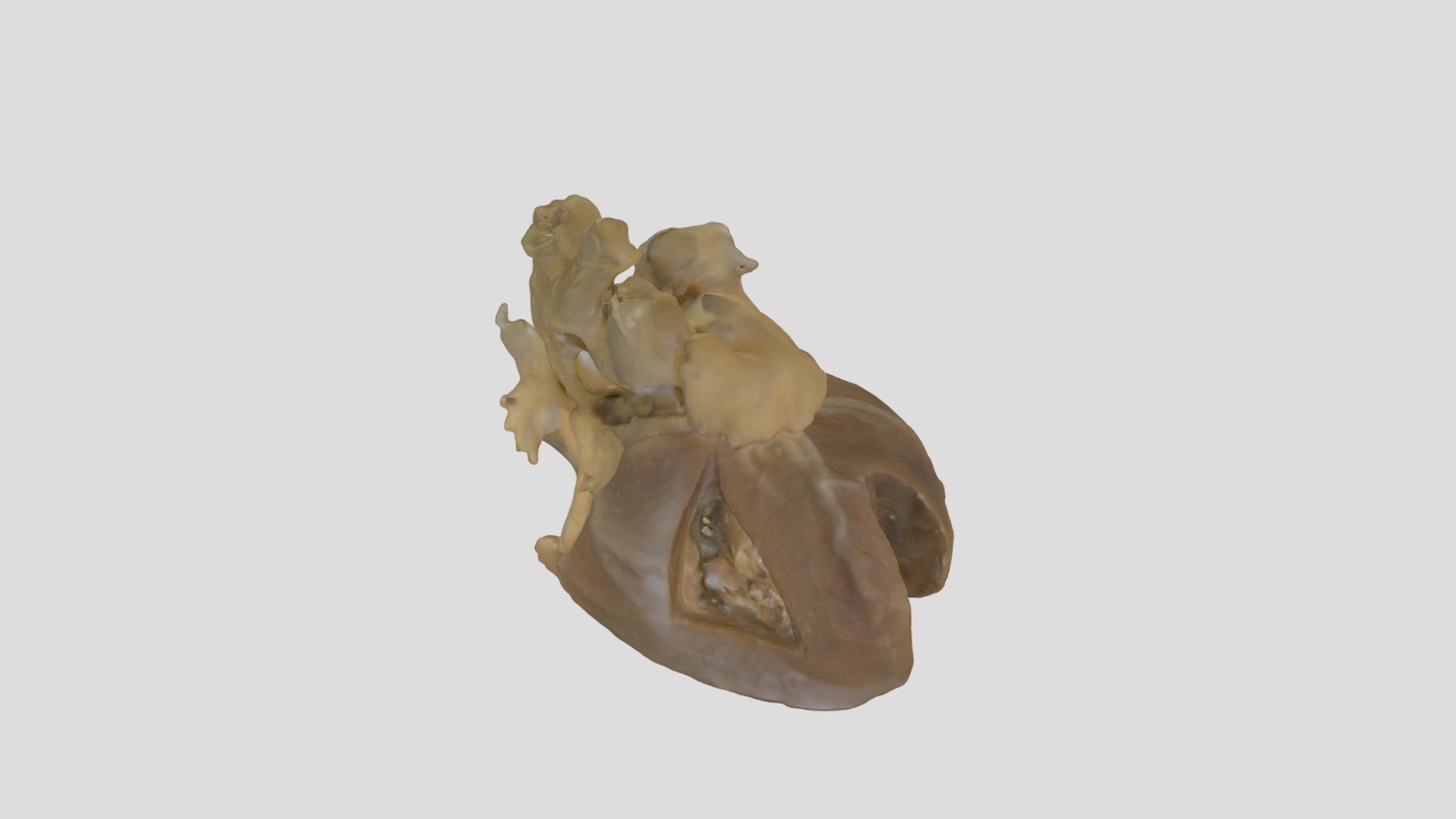 Truncus Arteriosus_A79107 - Download Free 3D model by lindseyamilgrom ...