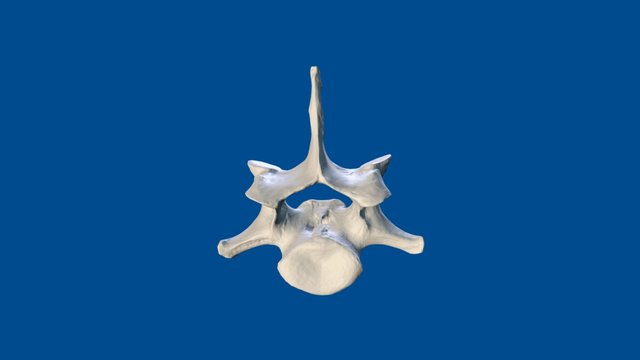 3D Dog Bone Project: C7 vertebra 3D Model