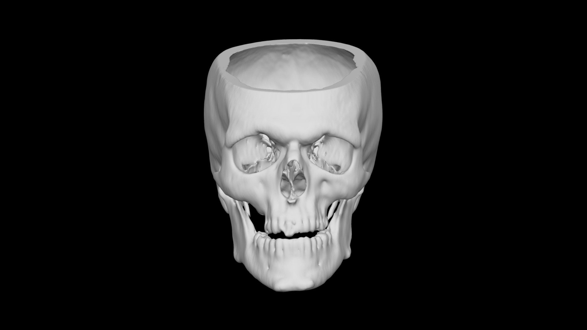 Skull Male 54yo