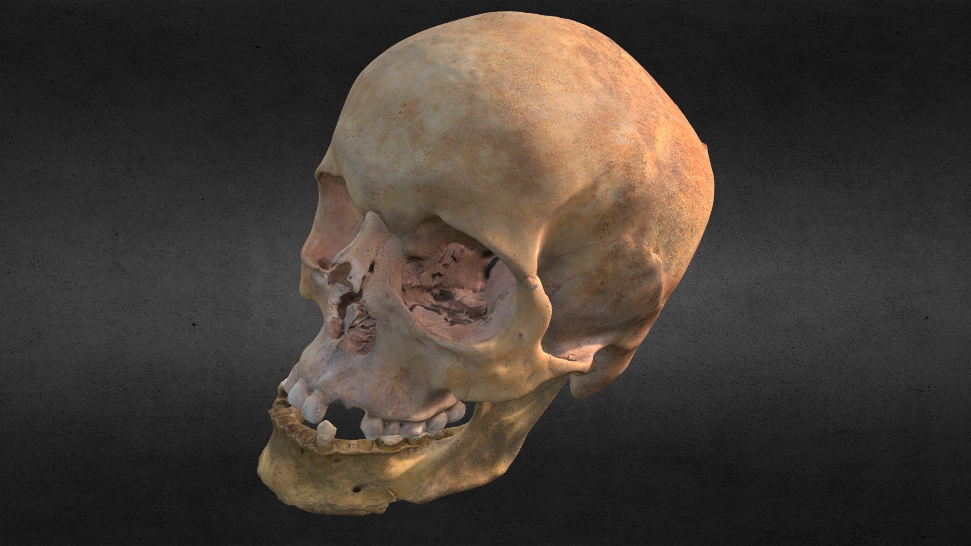 Skull 17 (Part 2: Head)