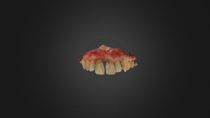 Maxillary flipper case 3D Model