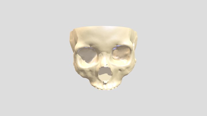 maxilar 3D Model