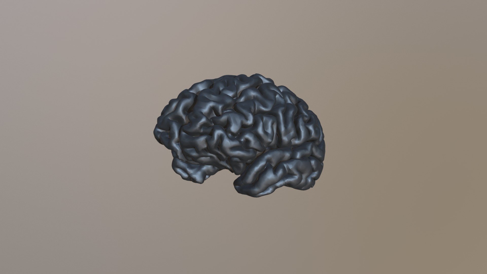 Toms Brain