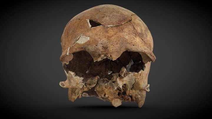 Cranium with injuries - 973180 – Modello 3D gratuito STL