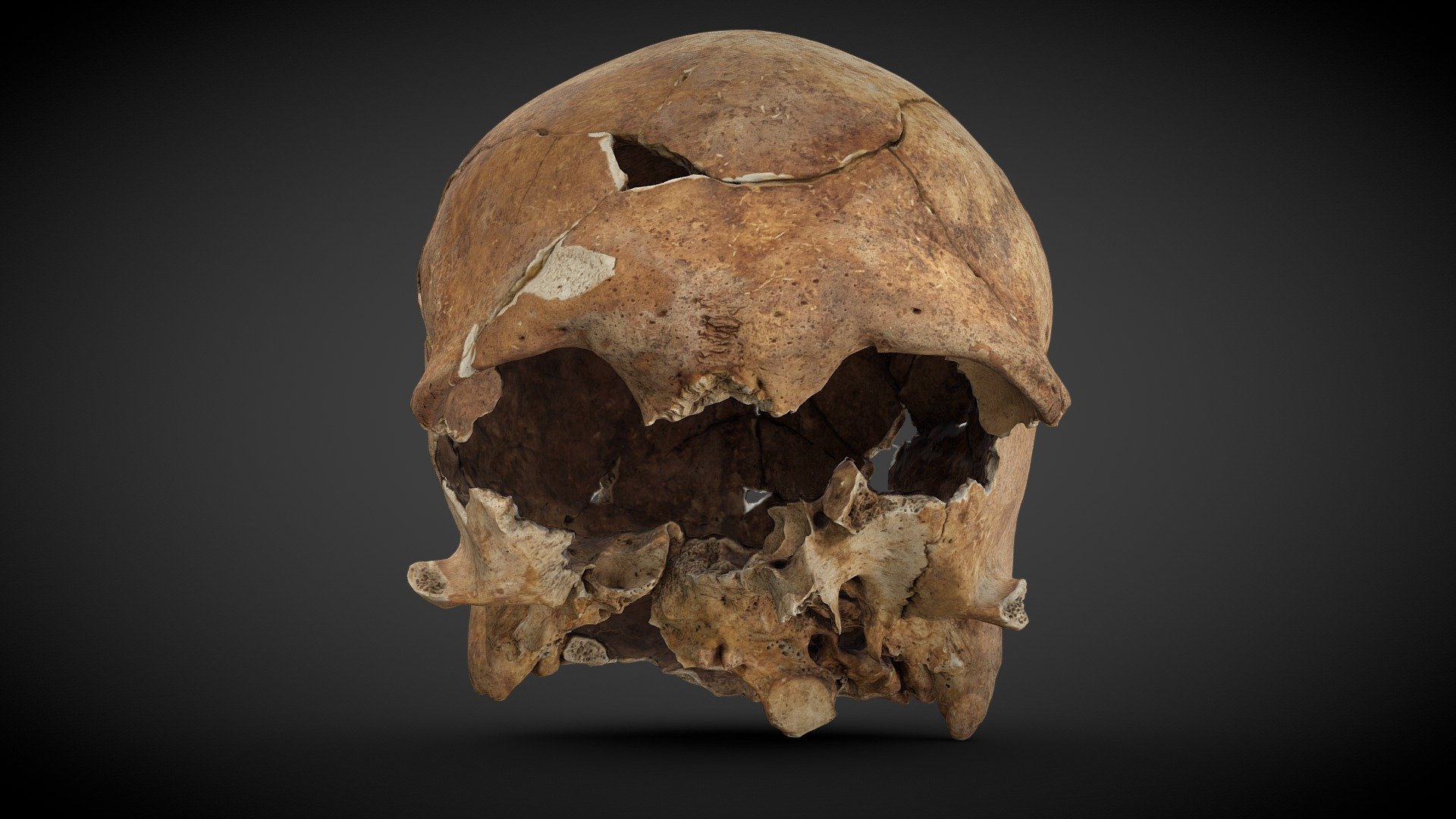 Cranium with injuries - 973180