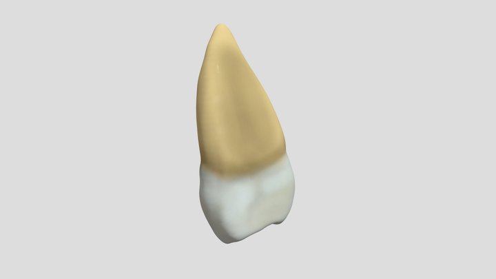 Maxillary Second Premolar (Right)