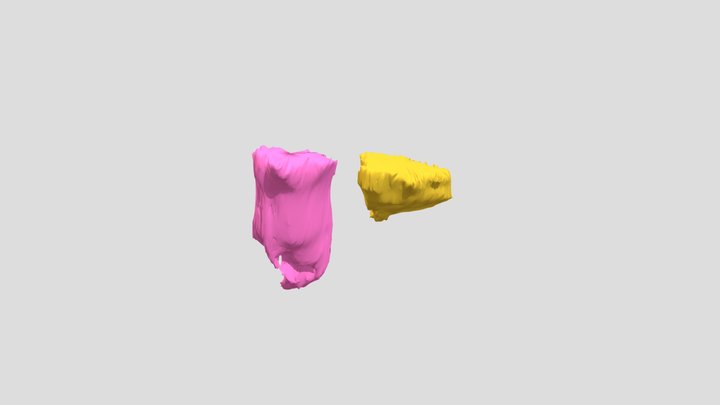 Bladder and Rectum 3D Model