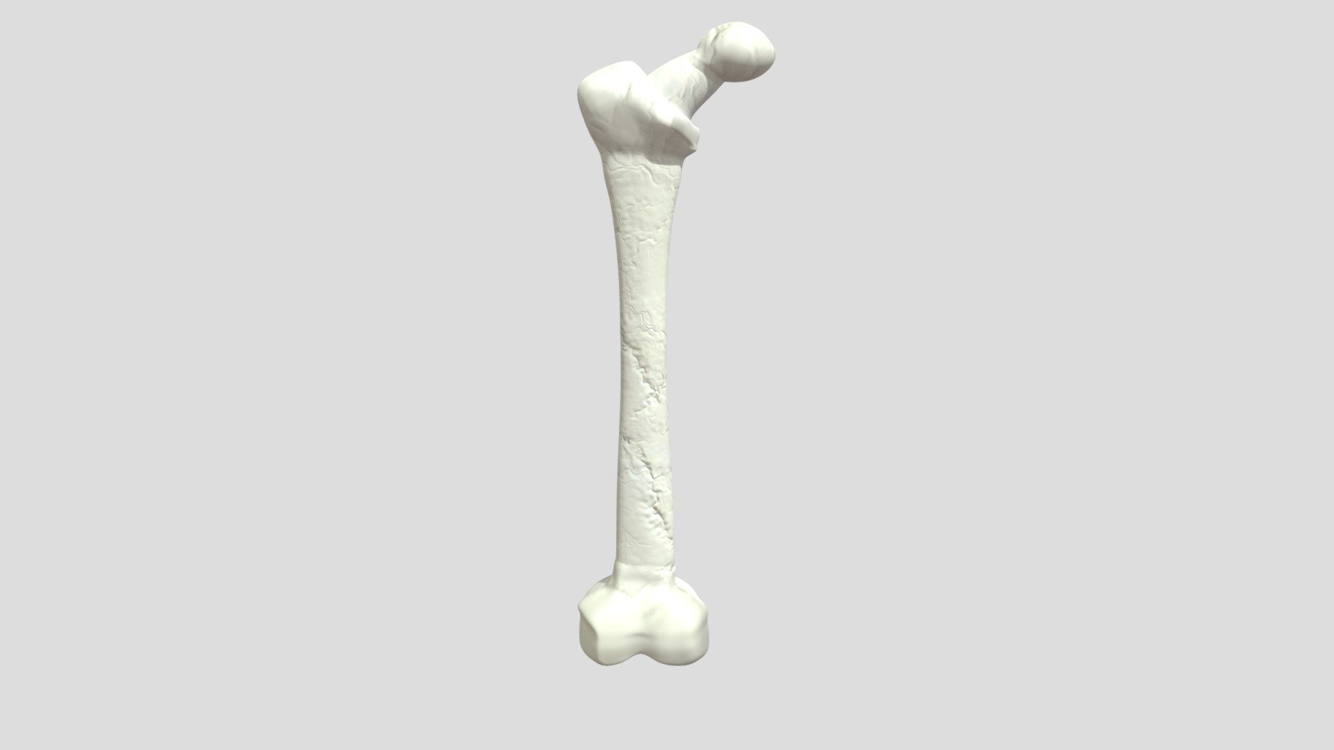 Femur bone