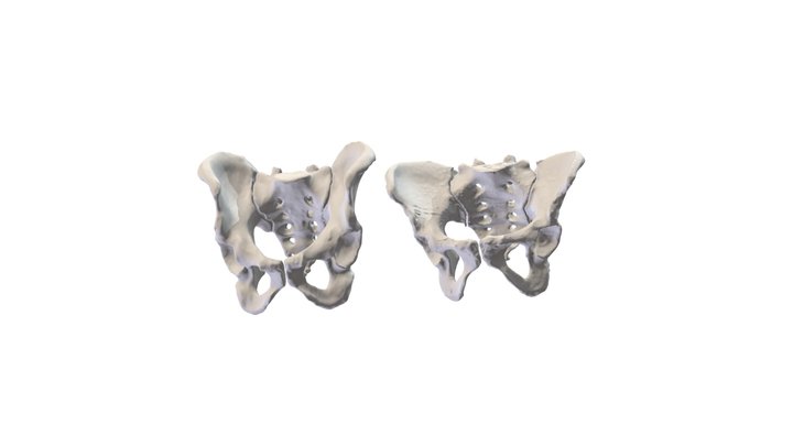Mystery Pelvi 1 & 2 3D Model