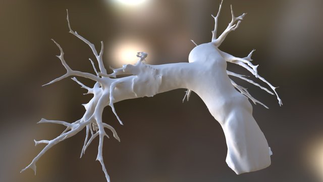 real pulmonary artery 3D Model