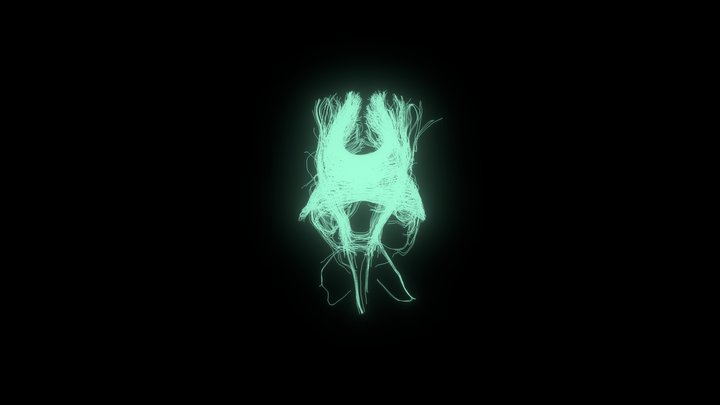 Projection Fibers from DWI/DTI Dataset 3D Model