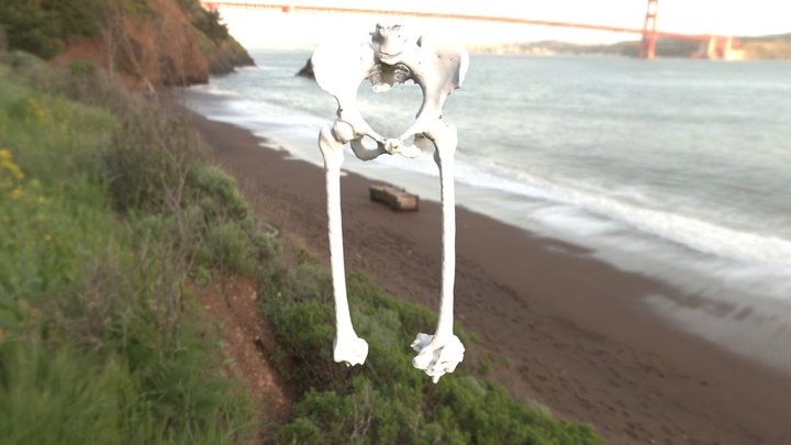 Femur Segmentation 3D Model
