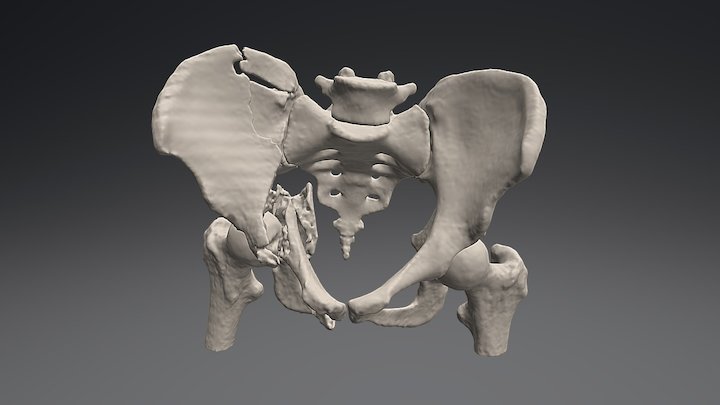 Acetabulum 3D models - Sketchfab