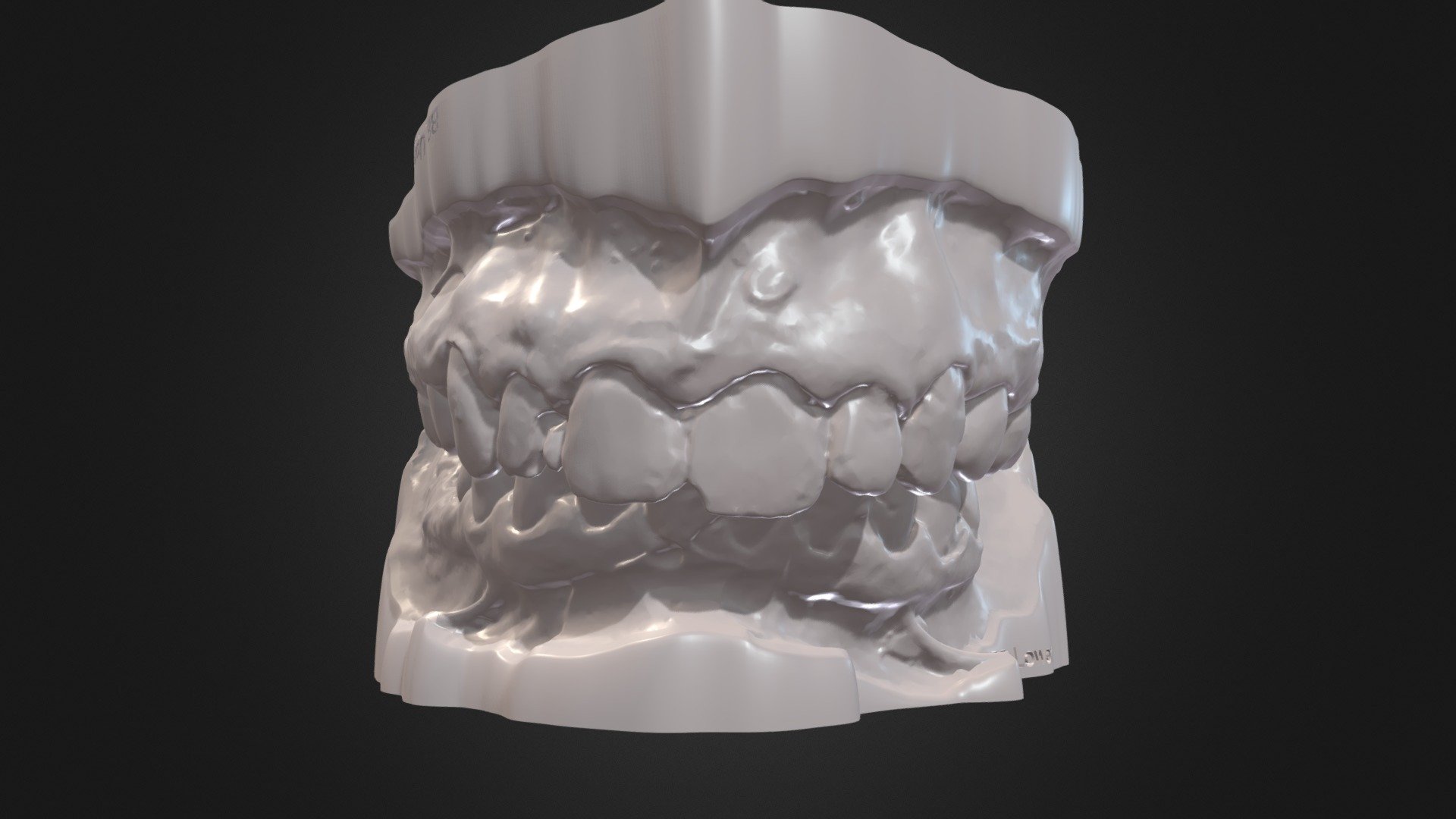 Case BB Occlusion