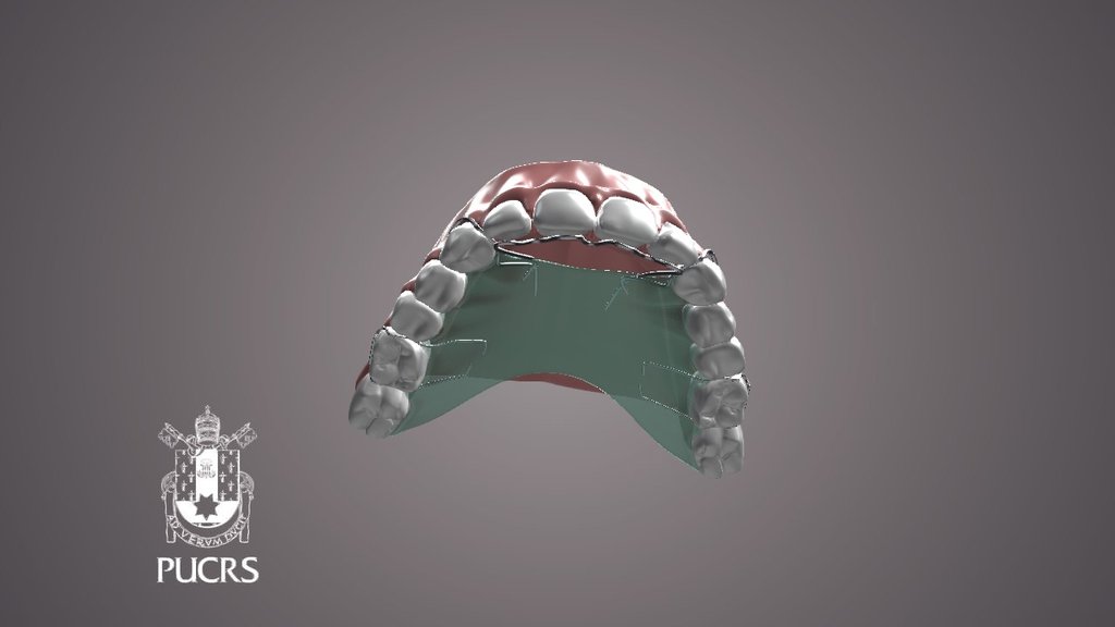 DENTES PALATAL CRIB 3D model by fuscaldo [65c43ce] Sketchfab