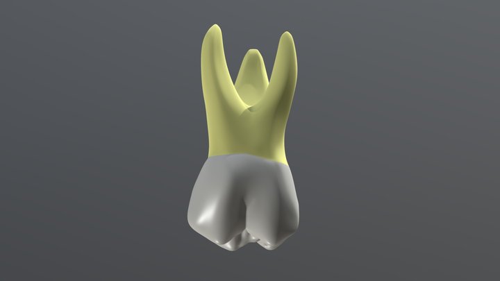 Maxillary Permanent First Molar 3D Model