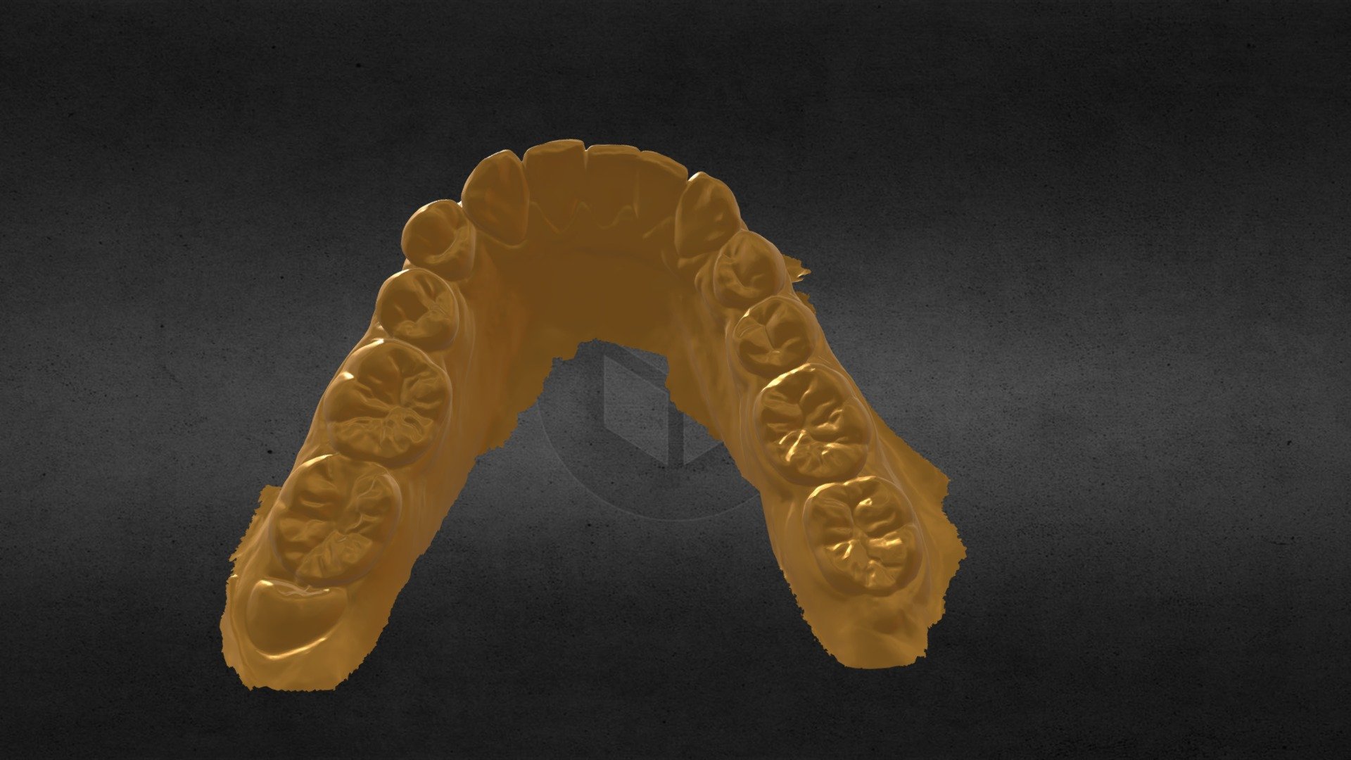 WithMe3d Lower Jaw Scan
