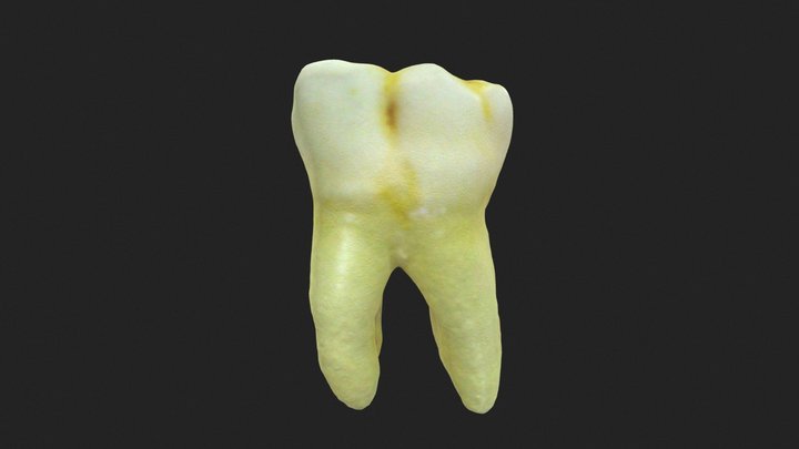 PRIMER MOLAR INFERIOR IZQUIERDO PERMANENTE 3D Model