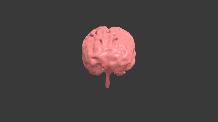 Segmentation_Brain 3D Model