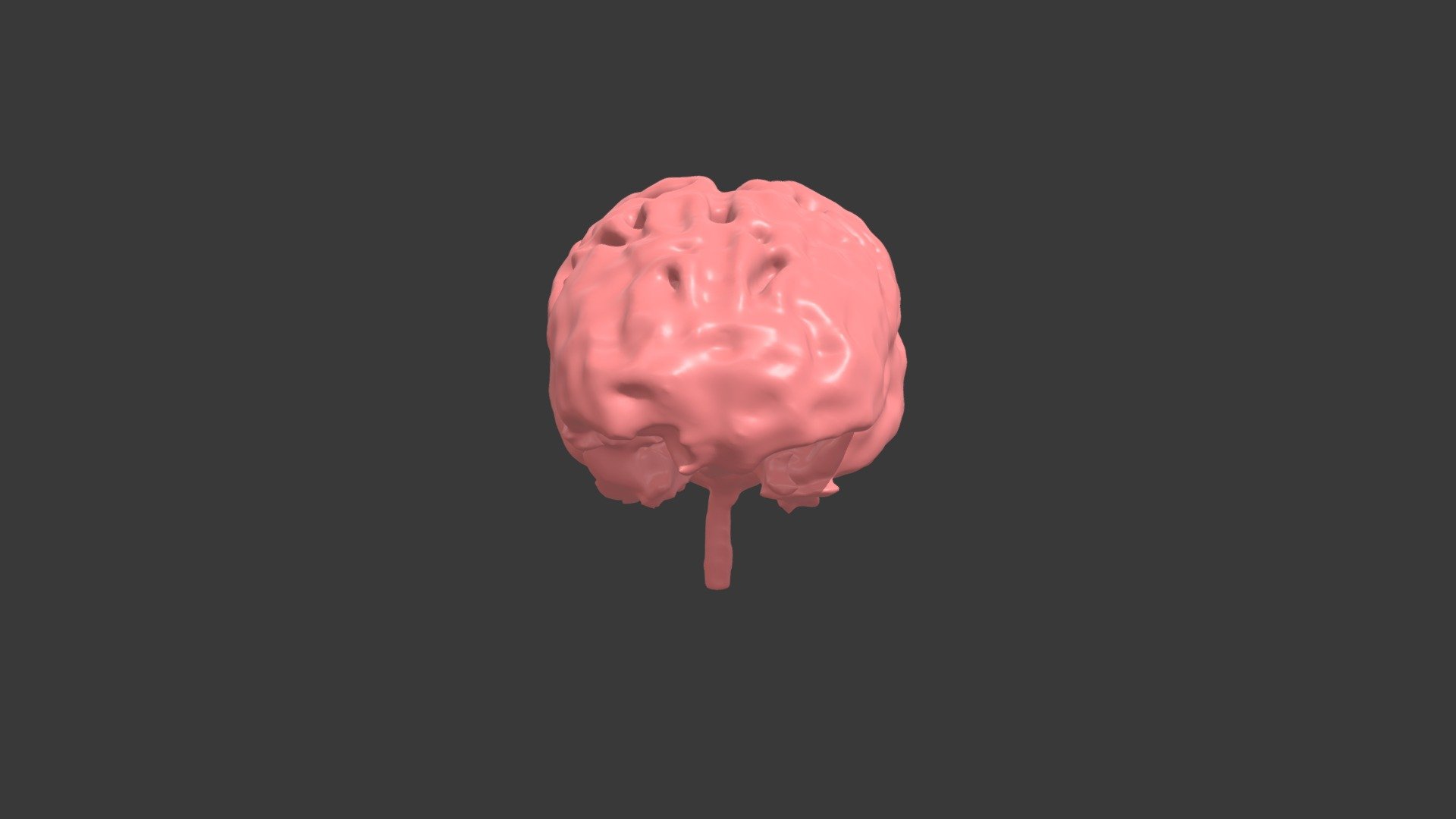 Segmentation_Brain — Sketchfab embed 3D viewer
