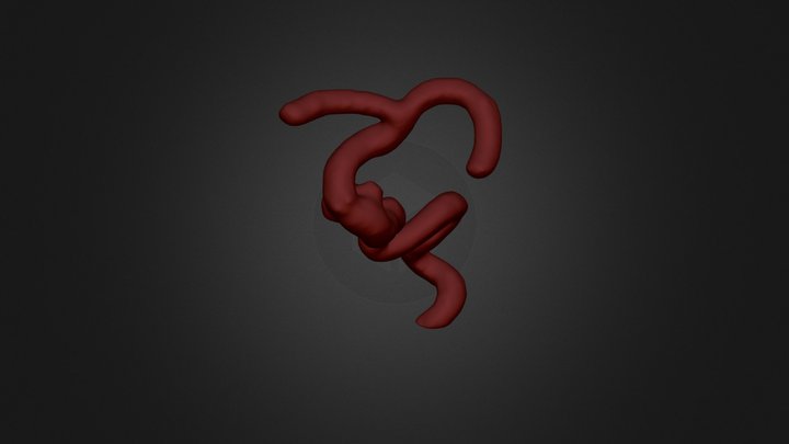 Aneurysm 3D Model