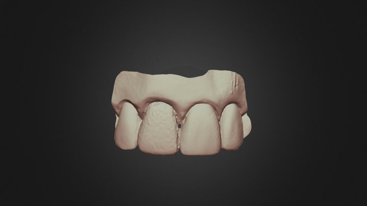 Tooth8,group12,scanner4 Upper Jaw 3D Model