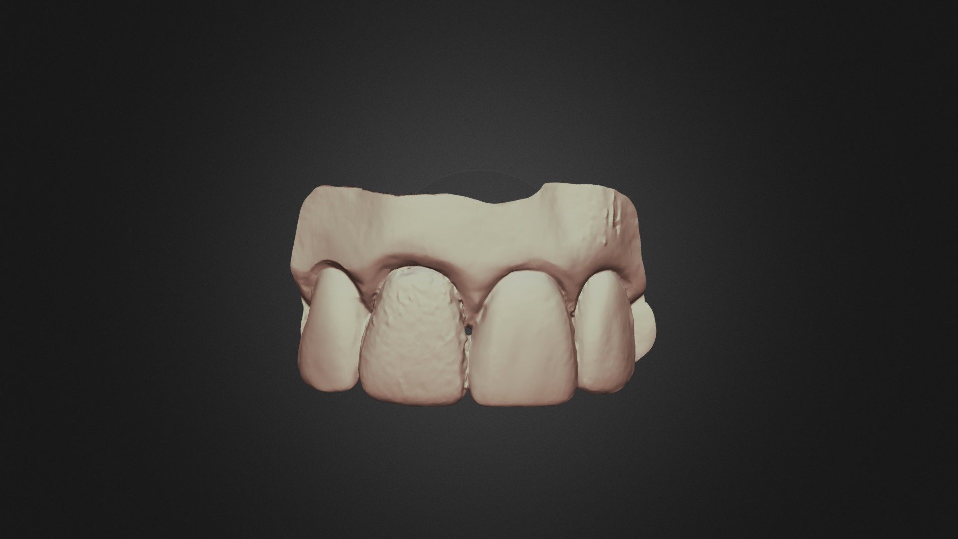 Tooth8,group12,scanner4 Upper Jaw