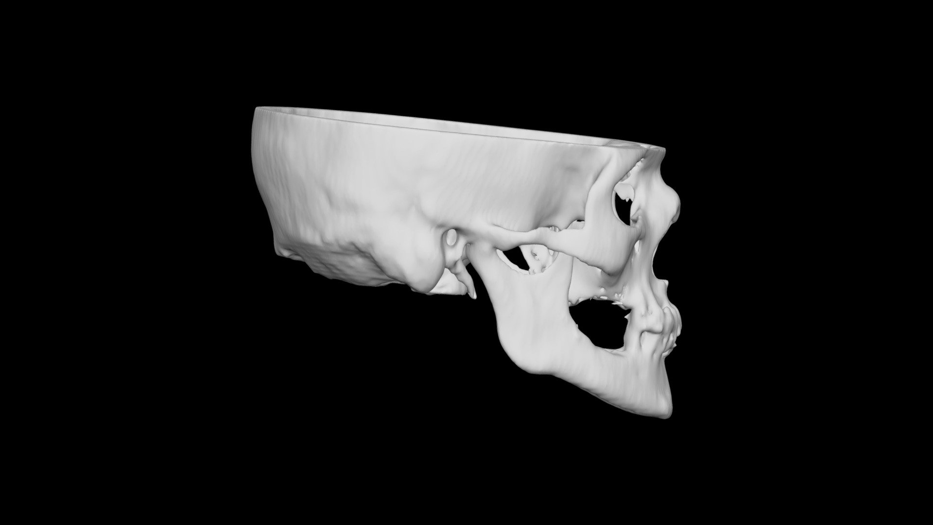 Skull Male 64yo